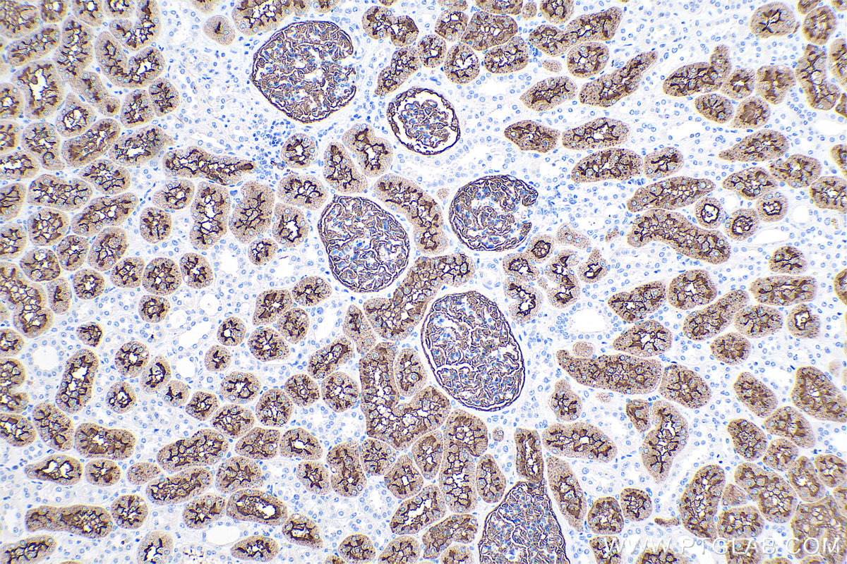 IHC staining of human kidney using 60034-3-Ig