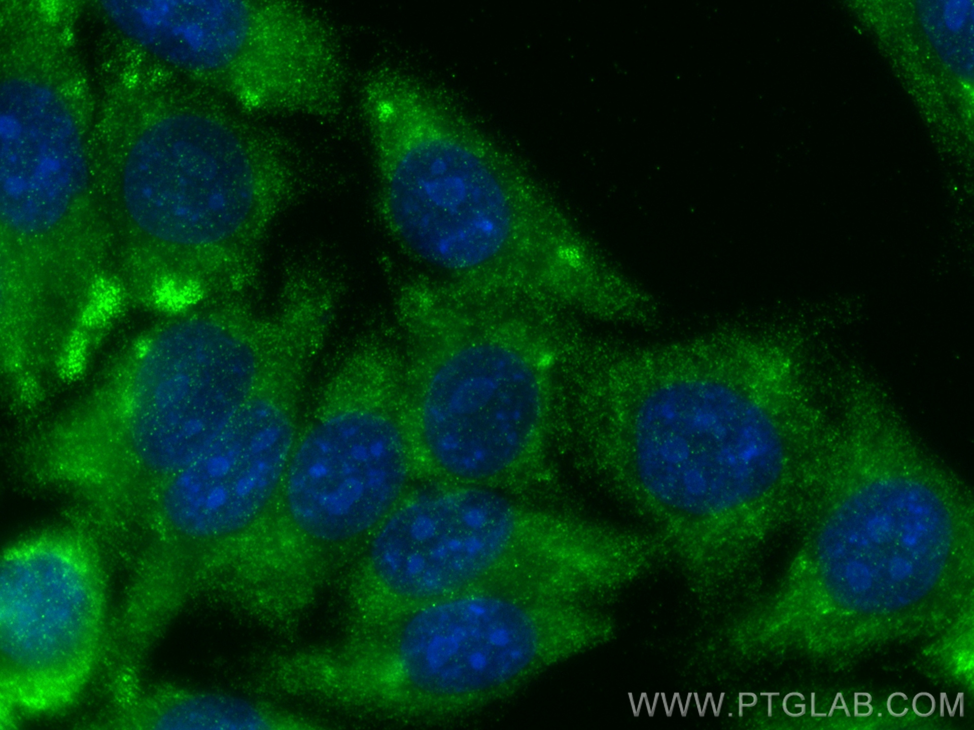 IF Staining of HepG2 using 30805-1-AP