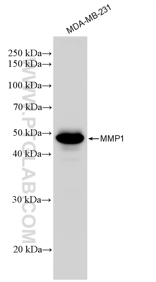 WB analysis of MDA-MB-231 using 83114-2-RR (same clone as 83114-2-PBS)