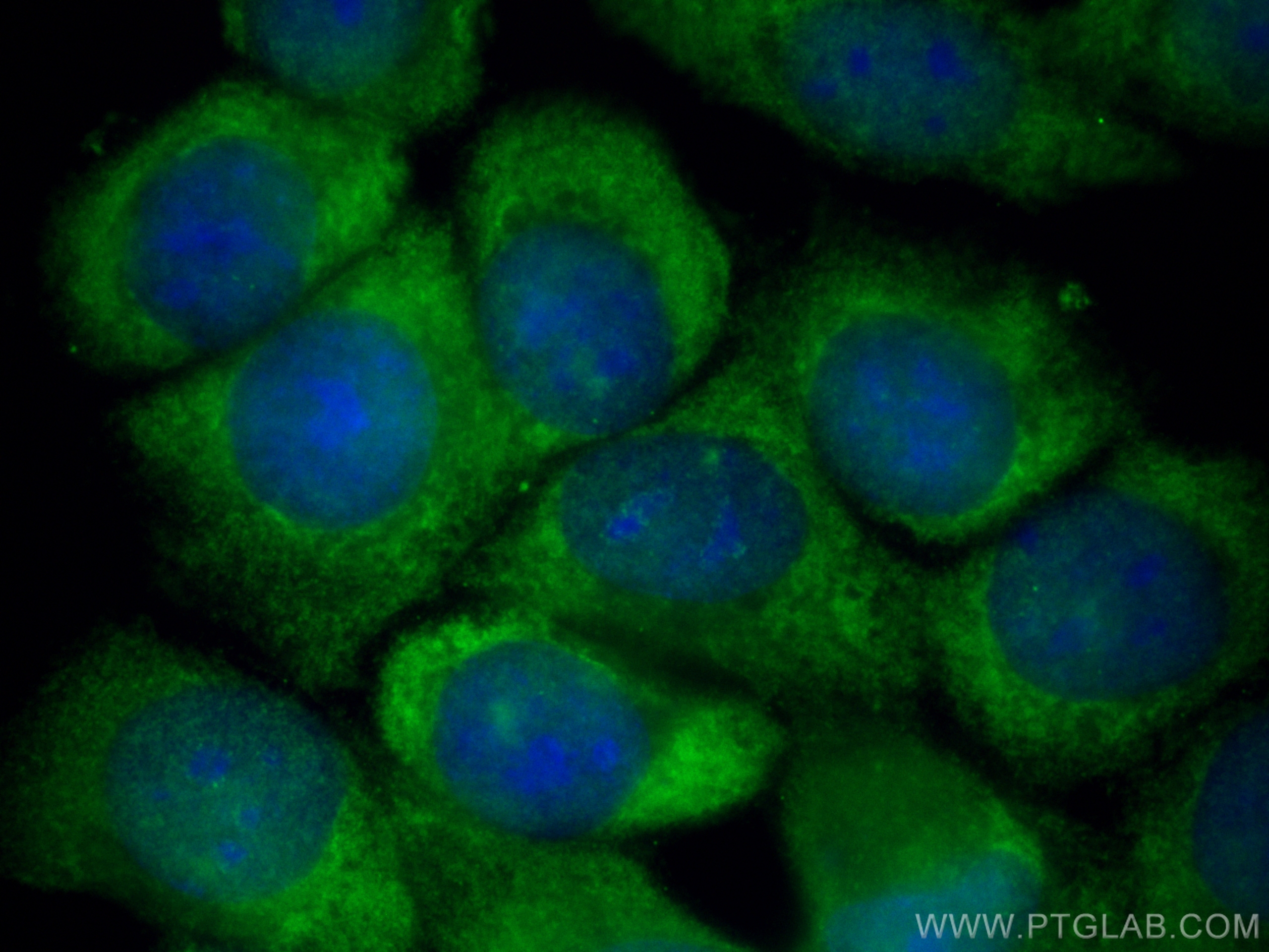 IF Staining of MCF-7 using CL488-83114-2