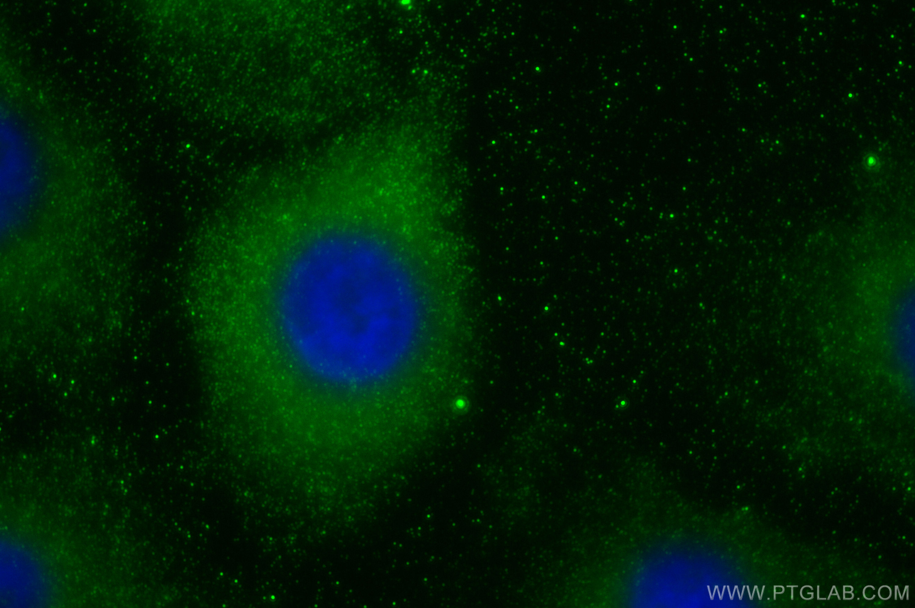 IF Staining of A549 using 30615-1-AP (same clone as 30615-1-PBS)