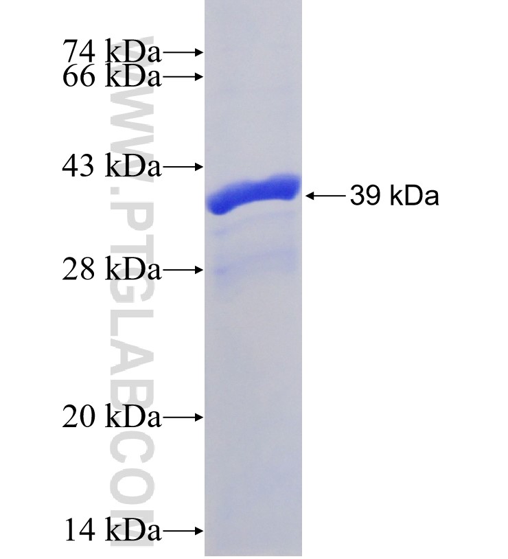 MMP11 fusion protein Ag31191 SDS-PAGE