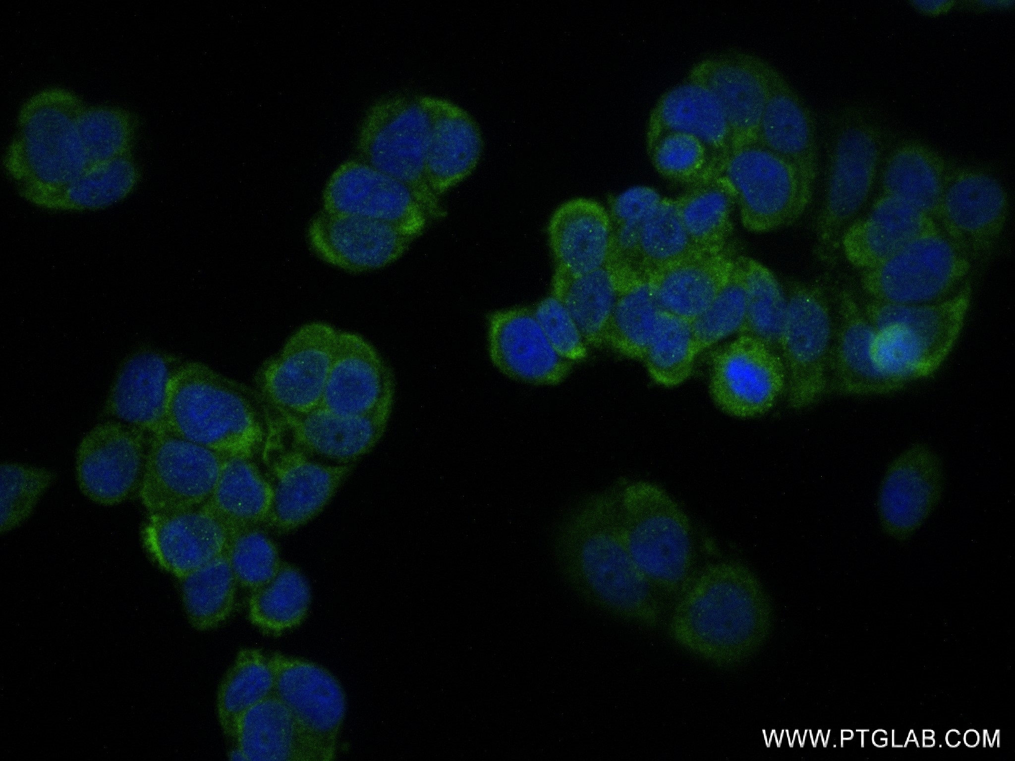 IF Staining of MCF-7 using 83188-2-RR