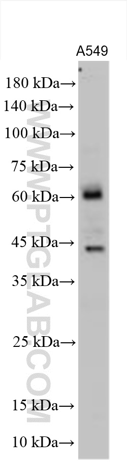 WB analysis using 14552-1-AP