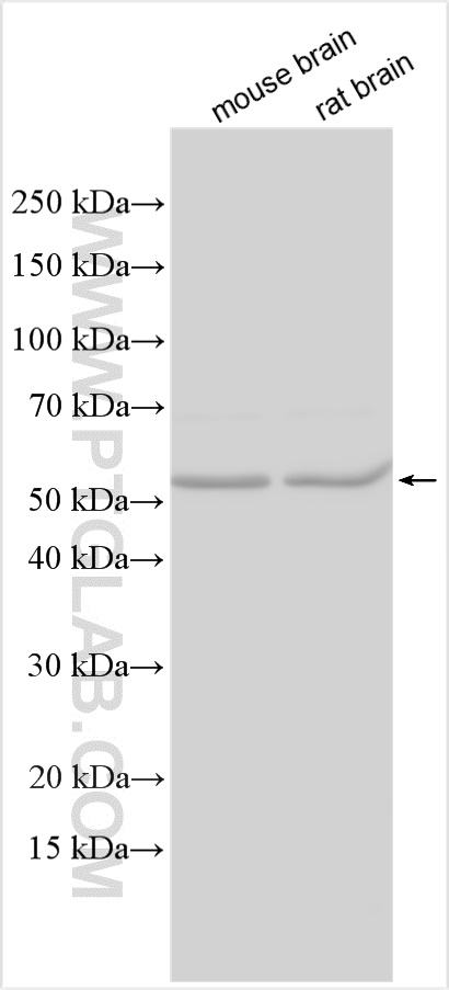 WB analysis using 30102-1-AP