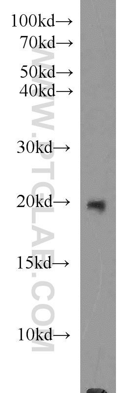 WB analysis of SKOV-3 using 18087-1-AP