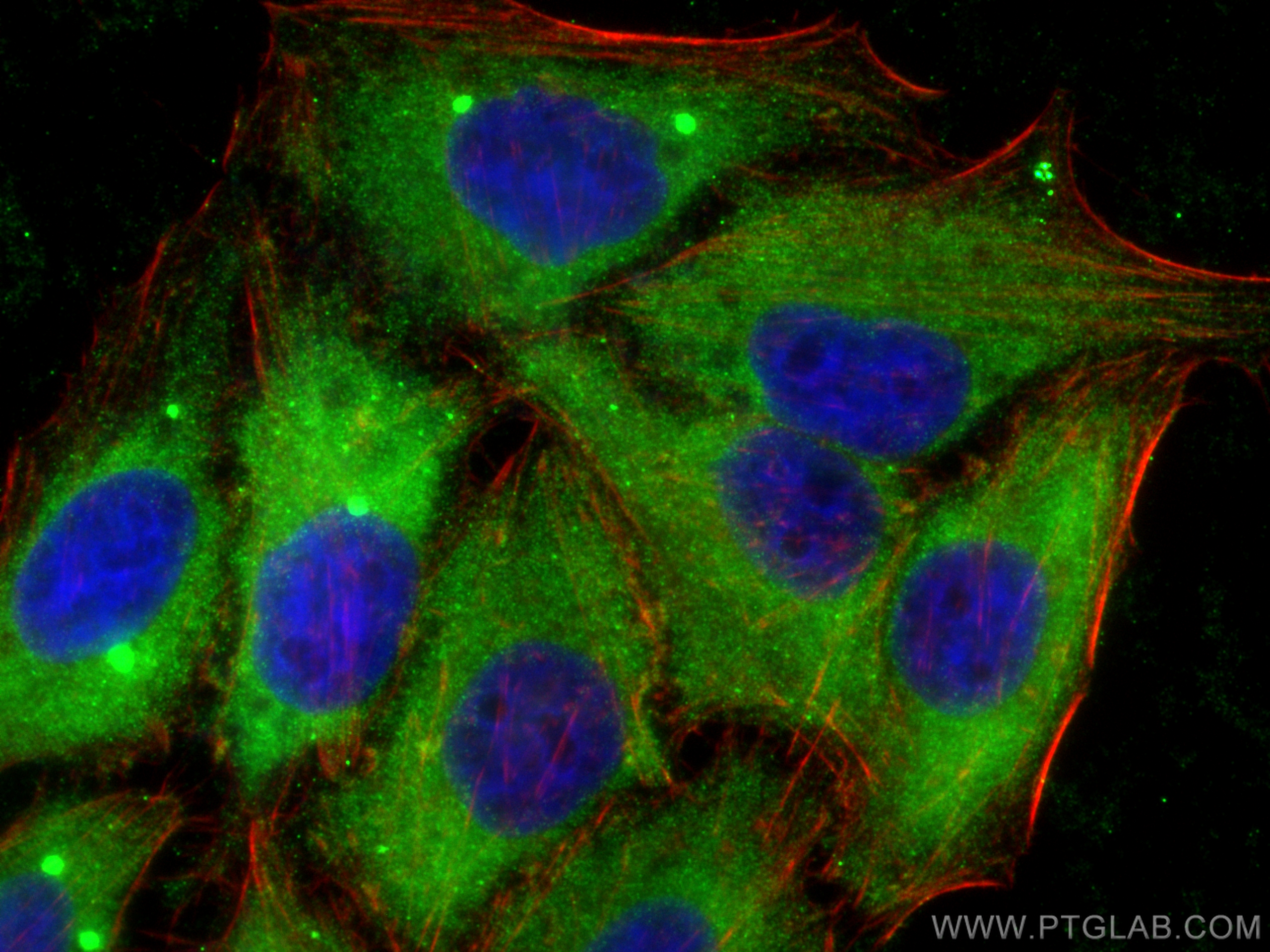 IF Staining of HepG2 using 17874-1-AP