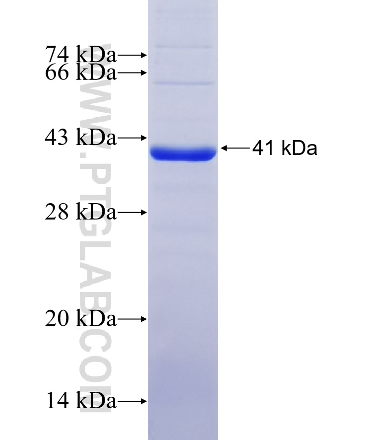 MMP8 fusion protein Ag12616 SDS-PAGE