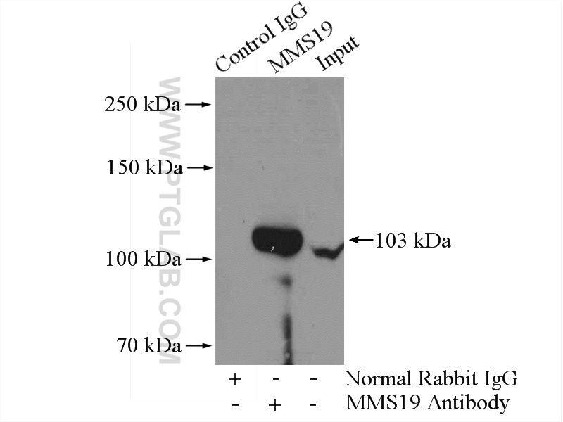 IP experiment of mouse brain using 66049-1-Ig (same clone as 66049-1-PBS)