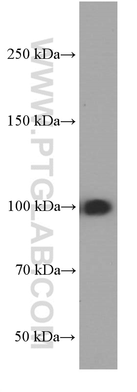 WB analysis of HeLa using 66049-1-Ig (same clone as 66049-1-PBS)