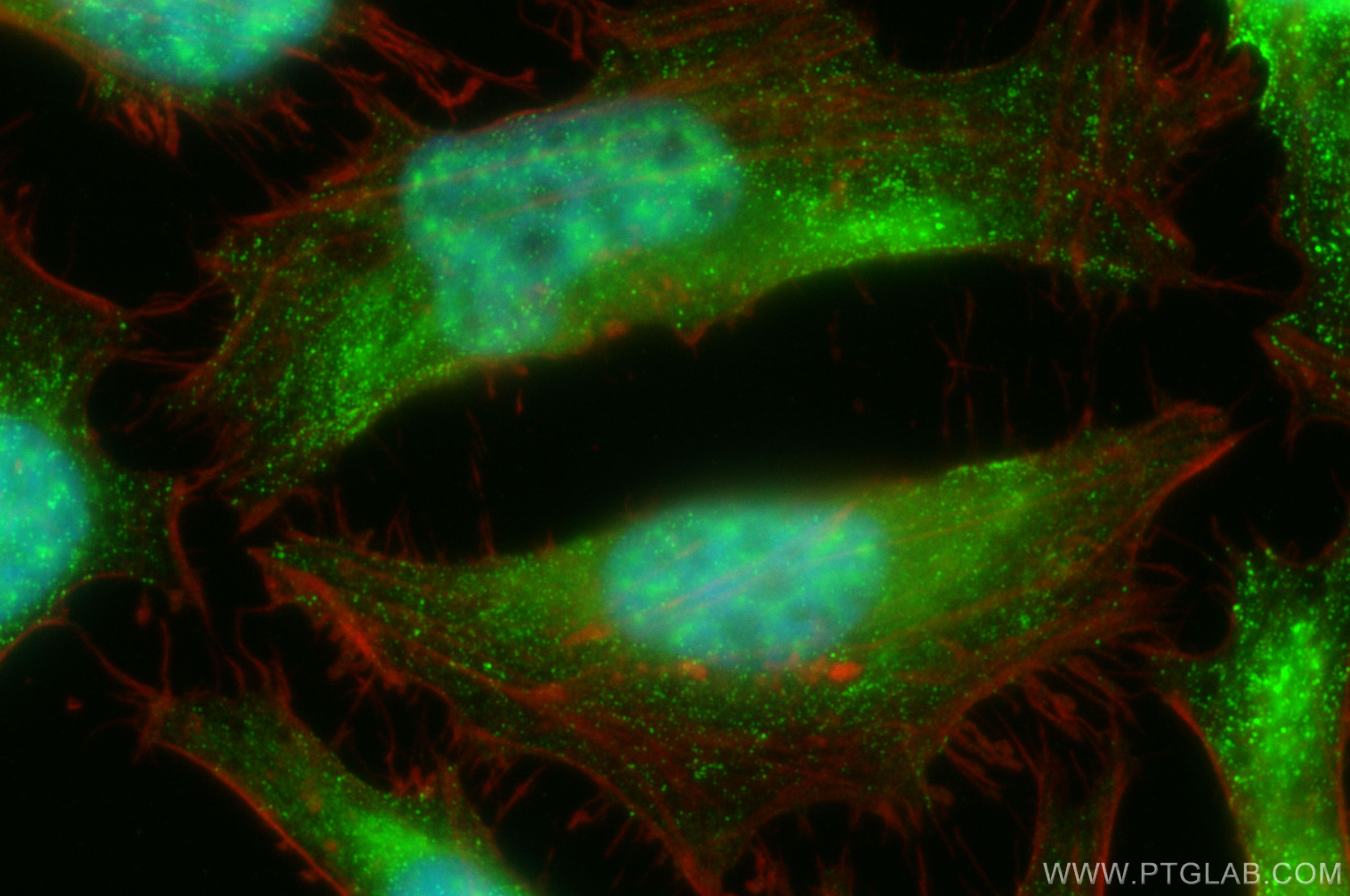 IF Staining of HeLa using 11719-1-AP