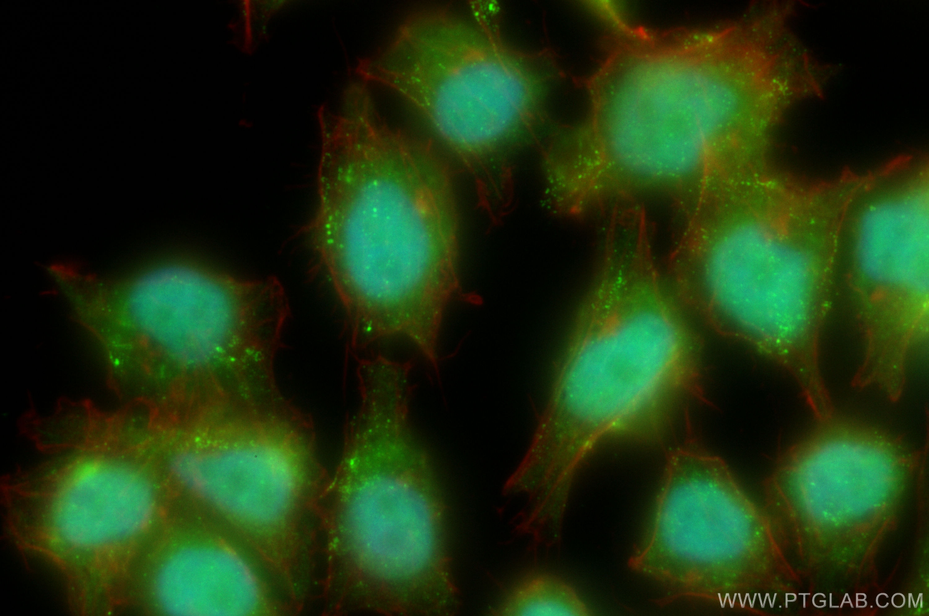 IF Staining of A375 using 11719-1-AP