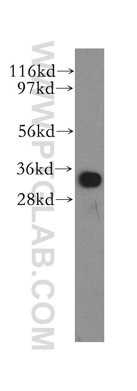 WB analysis of human liver using 11636-1-AP