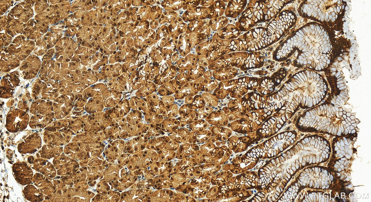 IHC staining of human stomach using 13576-1-AP