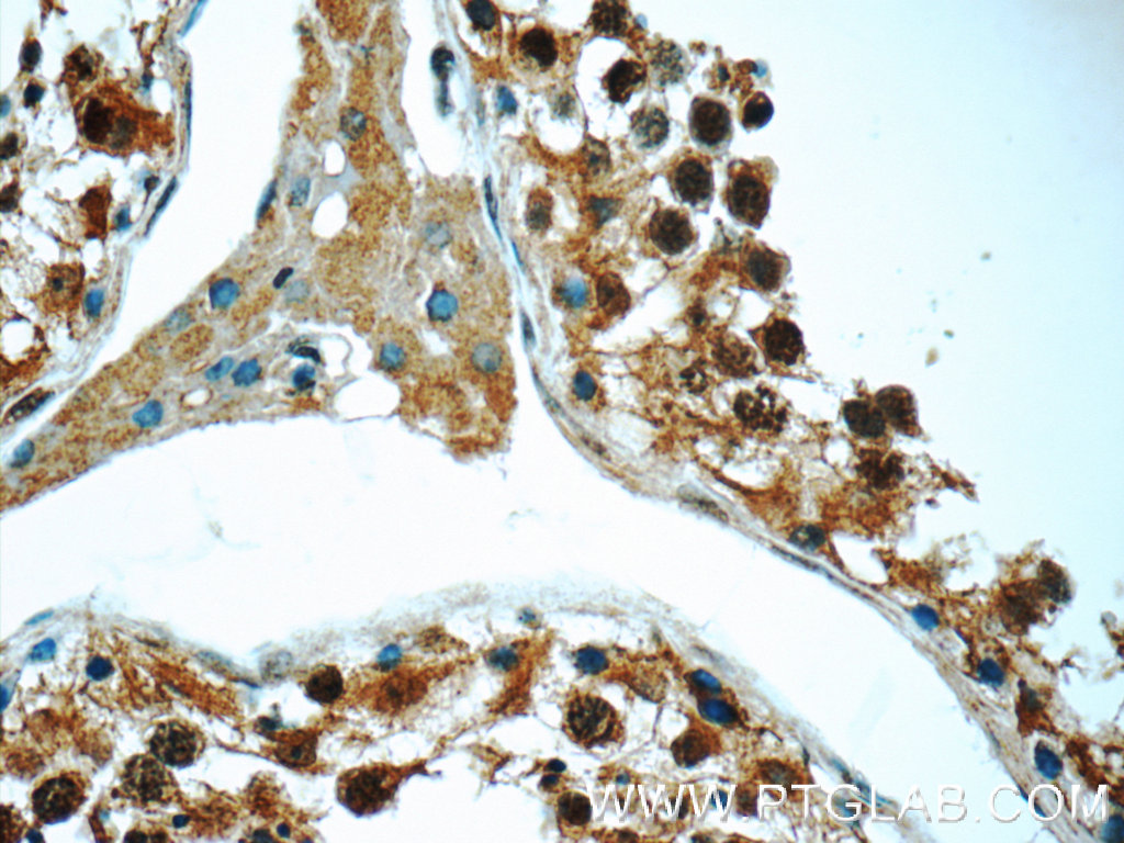 IHC staining of human testis using 12693-1-AP