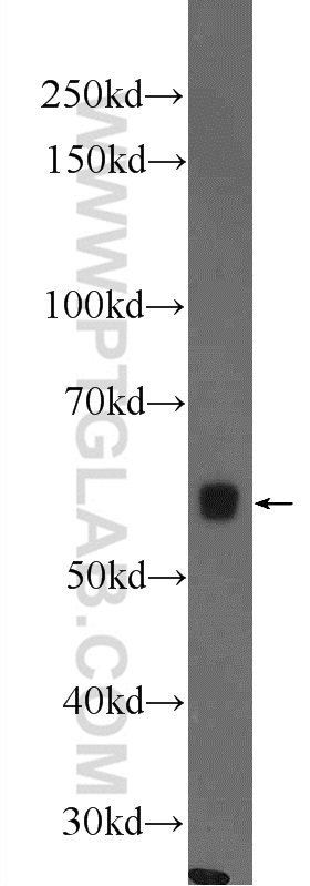 WB analysis of rat testis using 12693-1-AP