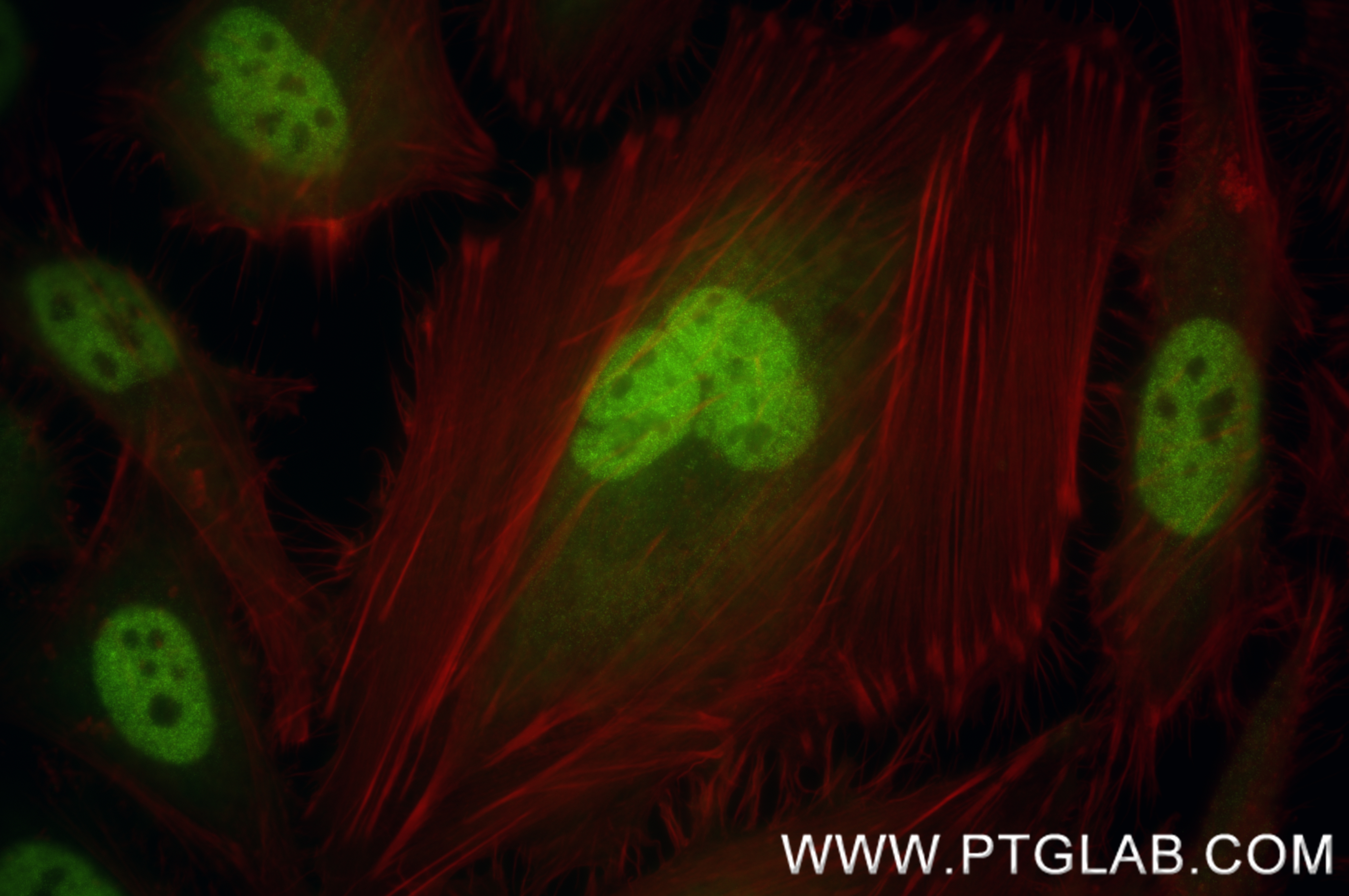 IF Staining of HeLa using 83648-1-RR (same clone as 83648-1-PBS)