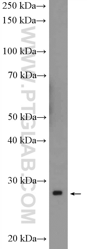 WB analysis of K-562 using 11669-1-AP