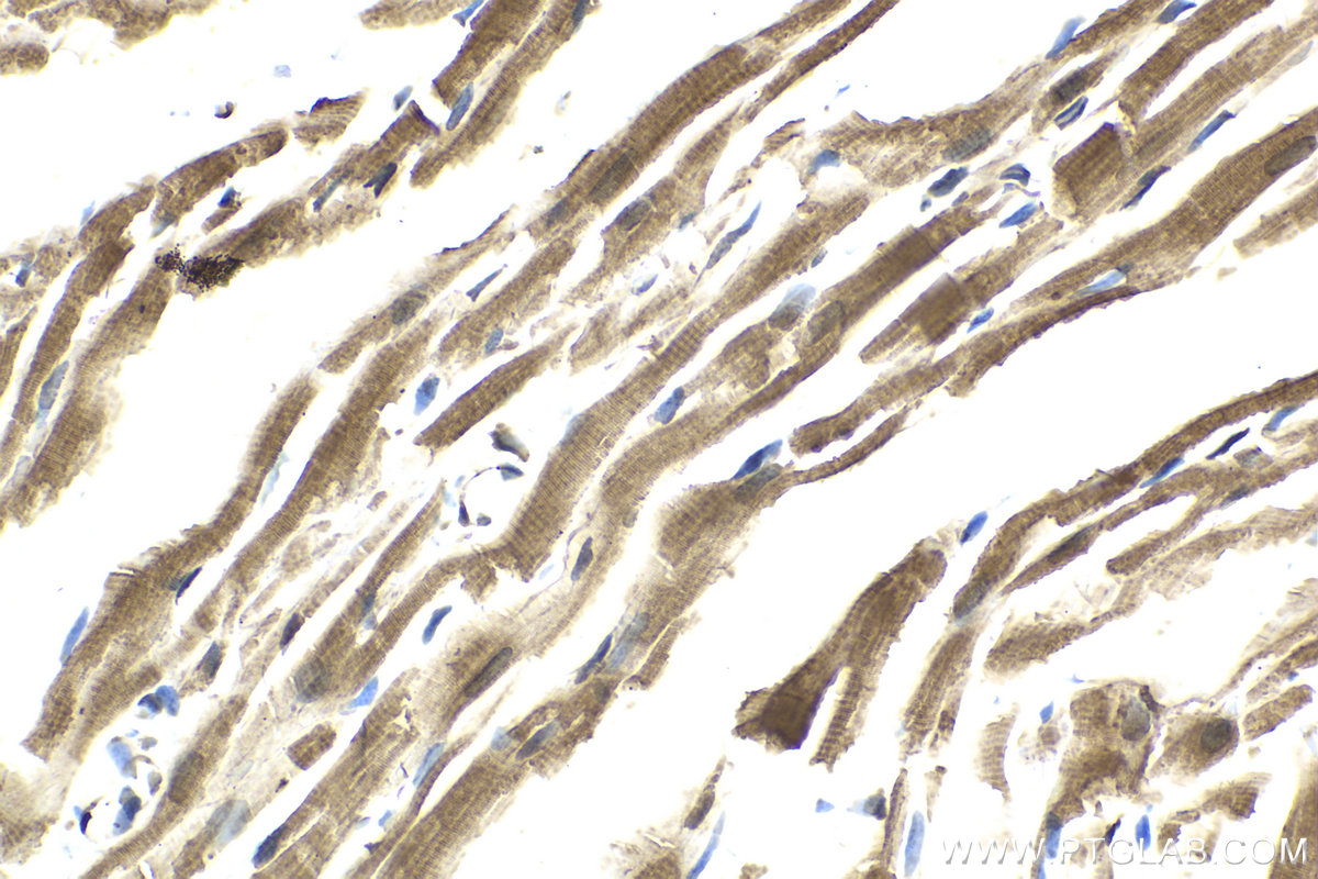 IHC staining of rat heart using 14416-1-AP