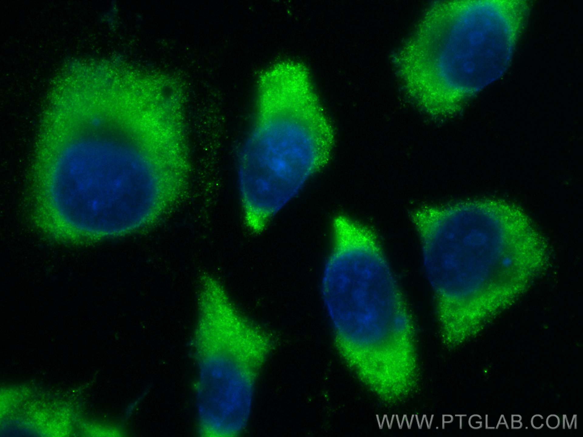 IF Staining of HeLa using CL488-68308