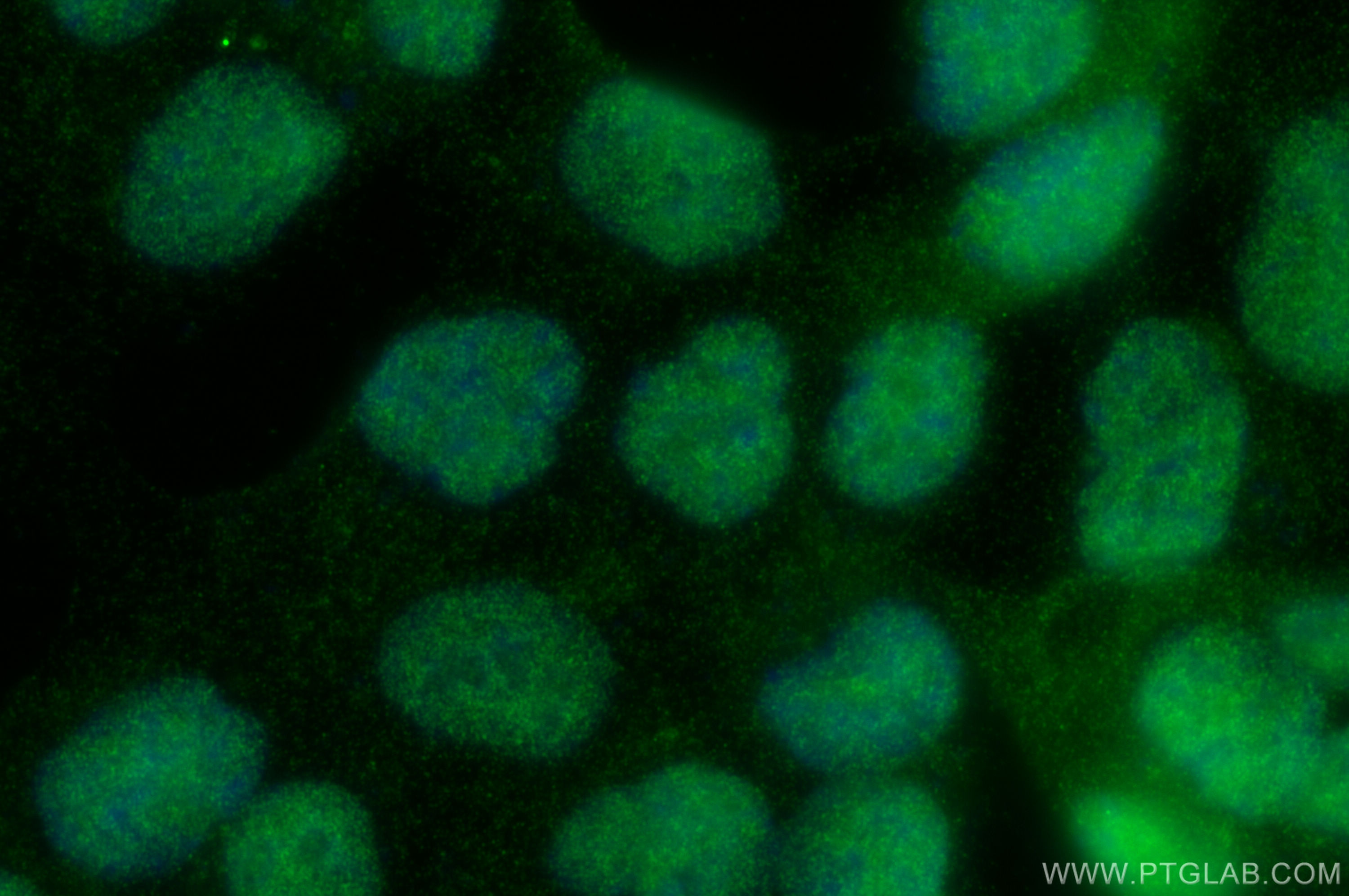 IF Staining of HCT 116 using 13842-1-AP