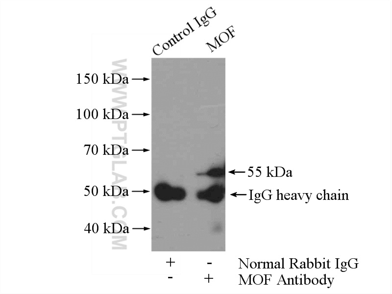 IP experiment of HeLa using 13842-1-AP