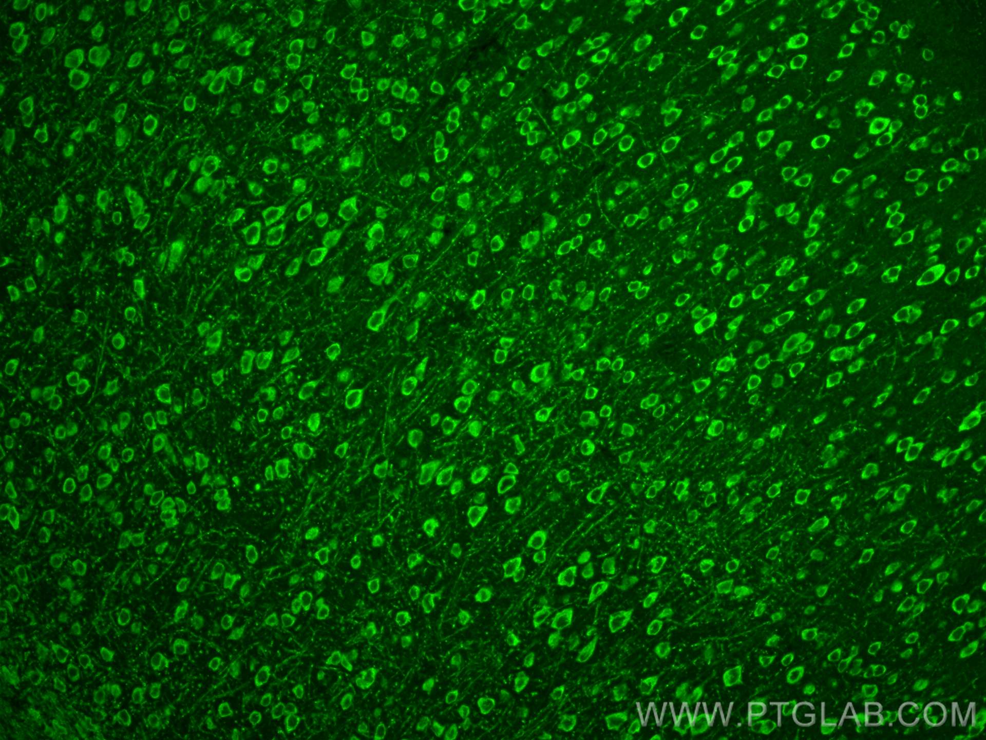 IF Staining of mouse brain using 12690-1-AP