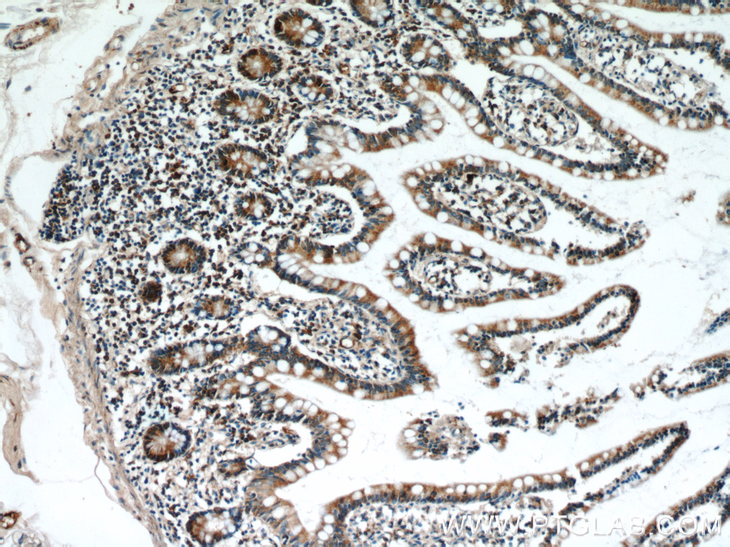 IHC staining of human small intestine using 17859-1-AP