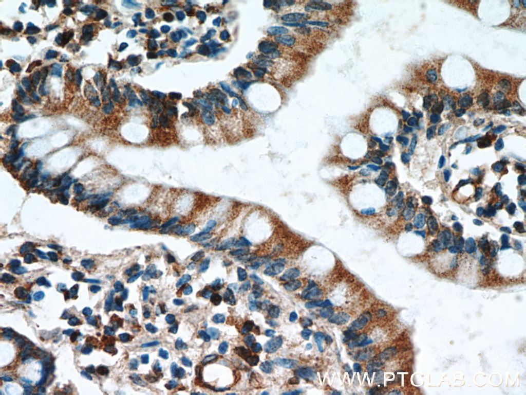 IHC staining of human small intestine using 17859-1-AP