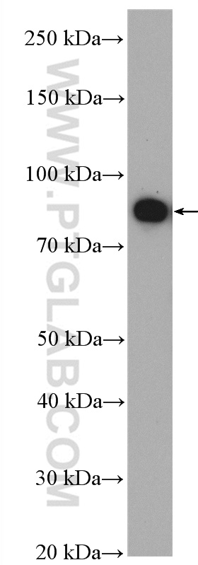 WB analysis of COLO 320 using 17859-1-AP