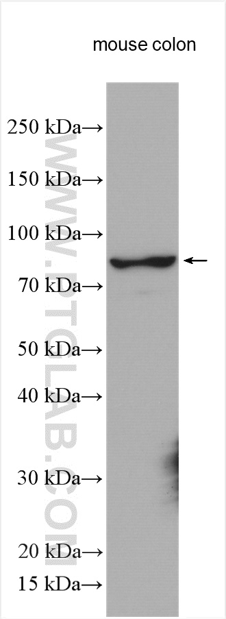 WB analysis using 17859-1-AP