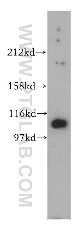 WB analysis of mouse testis using 14080-1-AP