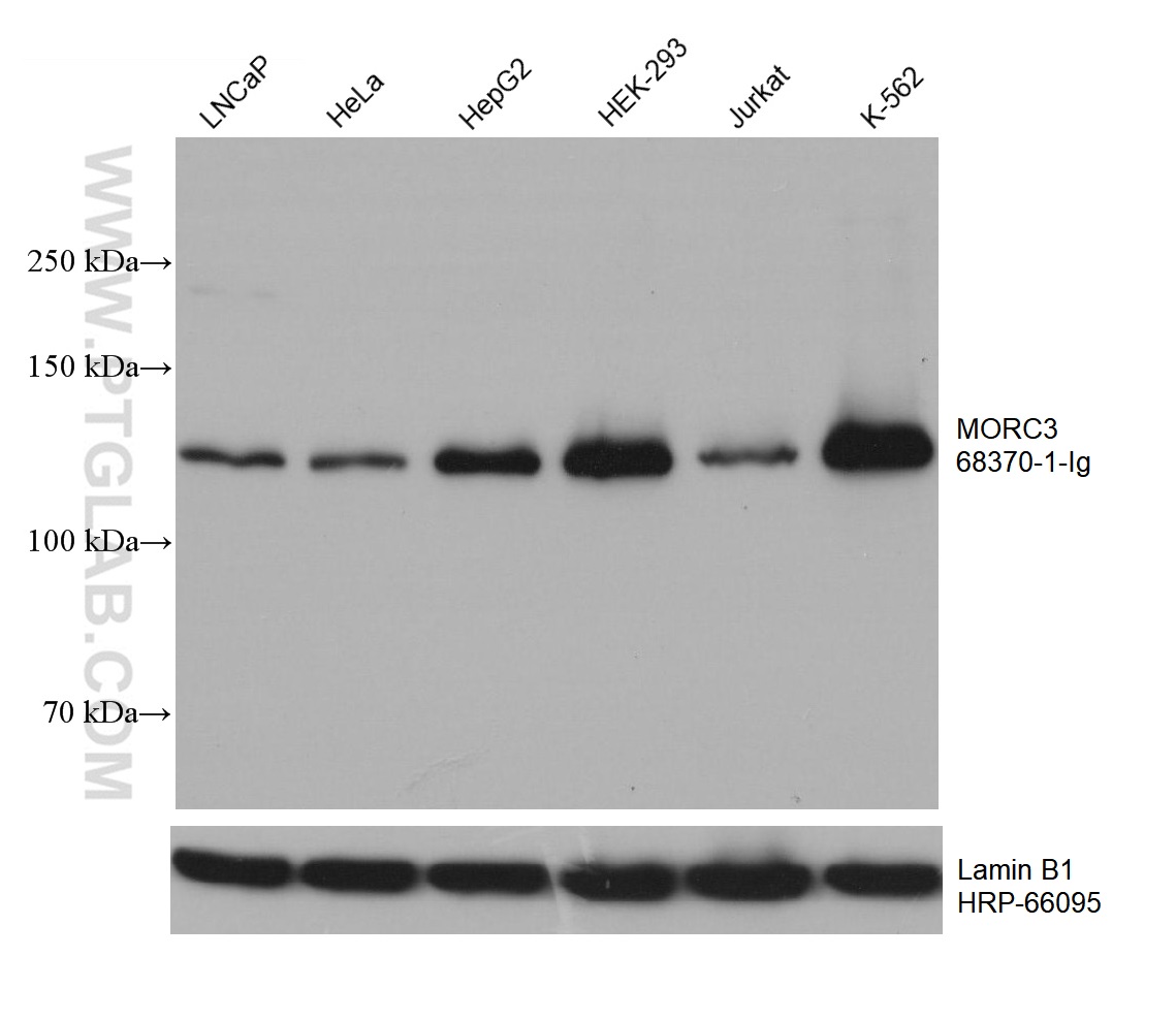 WB analysis using 68370-1-Ig (same clone as 68370-1-PBS)