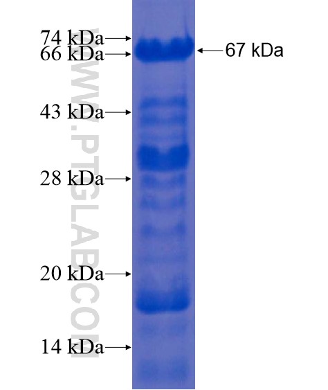 MORC3 fusion protein Ag21867 SDS-PAGE