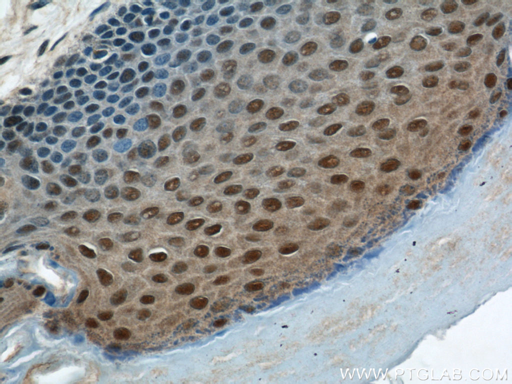 IHC staining of human skin using 55257-1-AP