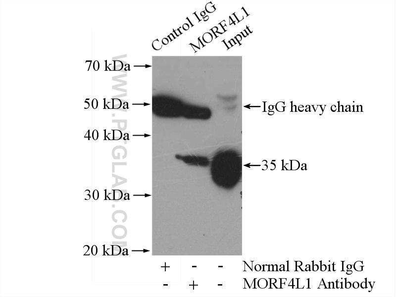 IP experiment of HEK-293 using 55257-1-AP