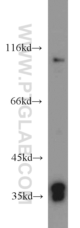 WB analysis of HEK-293 using 55257-1-AP (same clone as 55257-1-PBS)