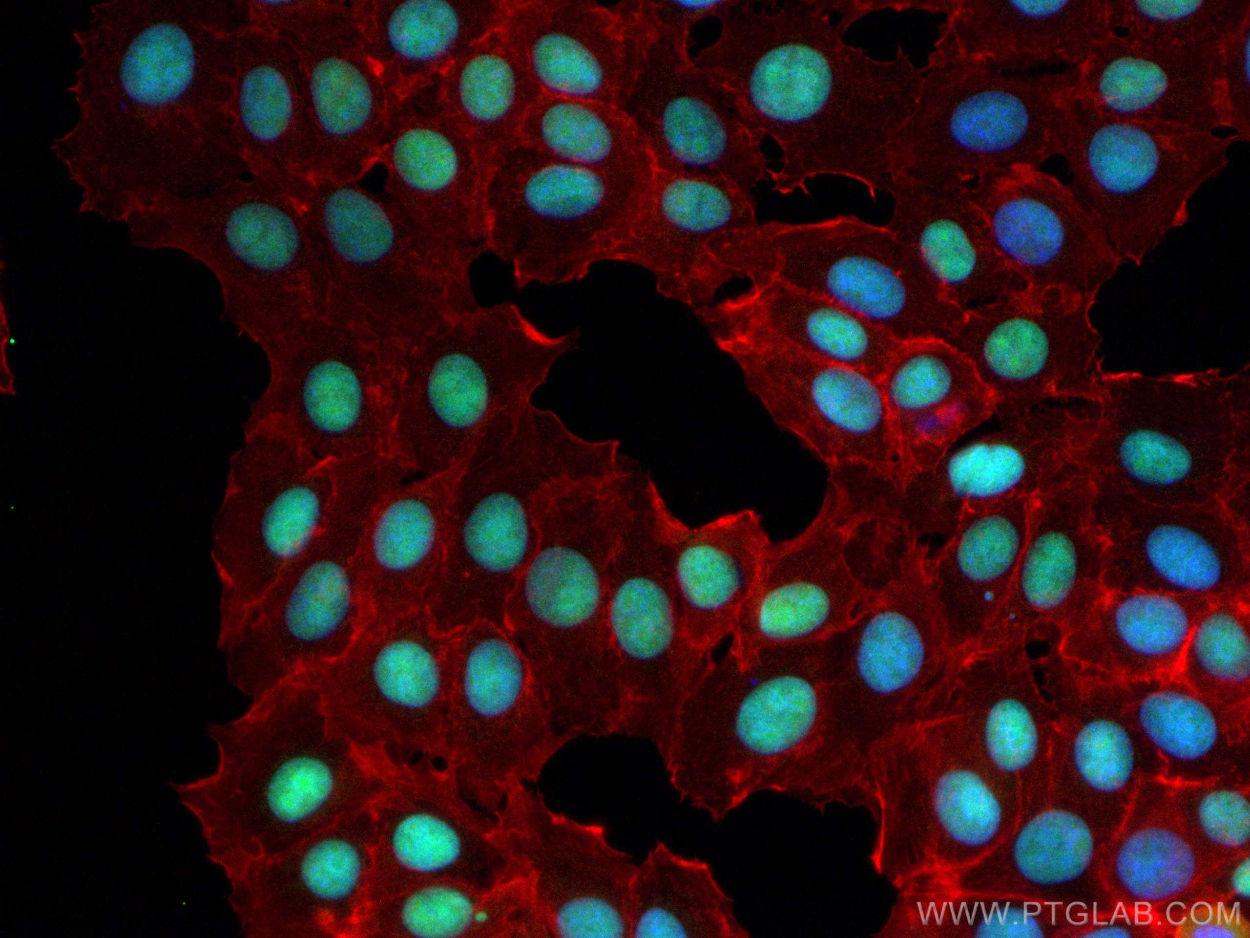 IF Staining of MCF-7 using 14710-1-AP