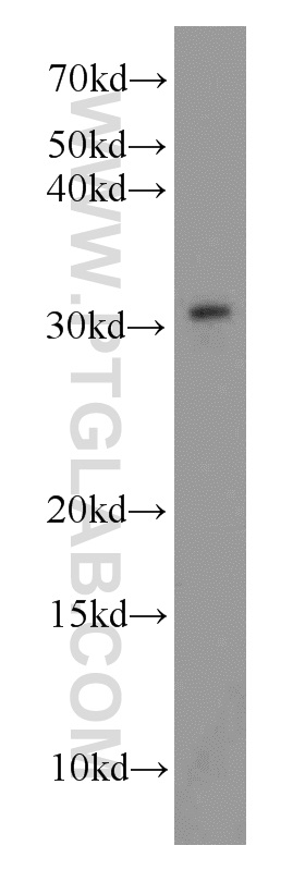 WB analysis of HeLa using 14710-1-AP