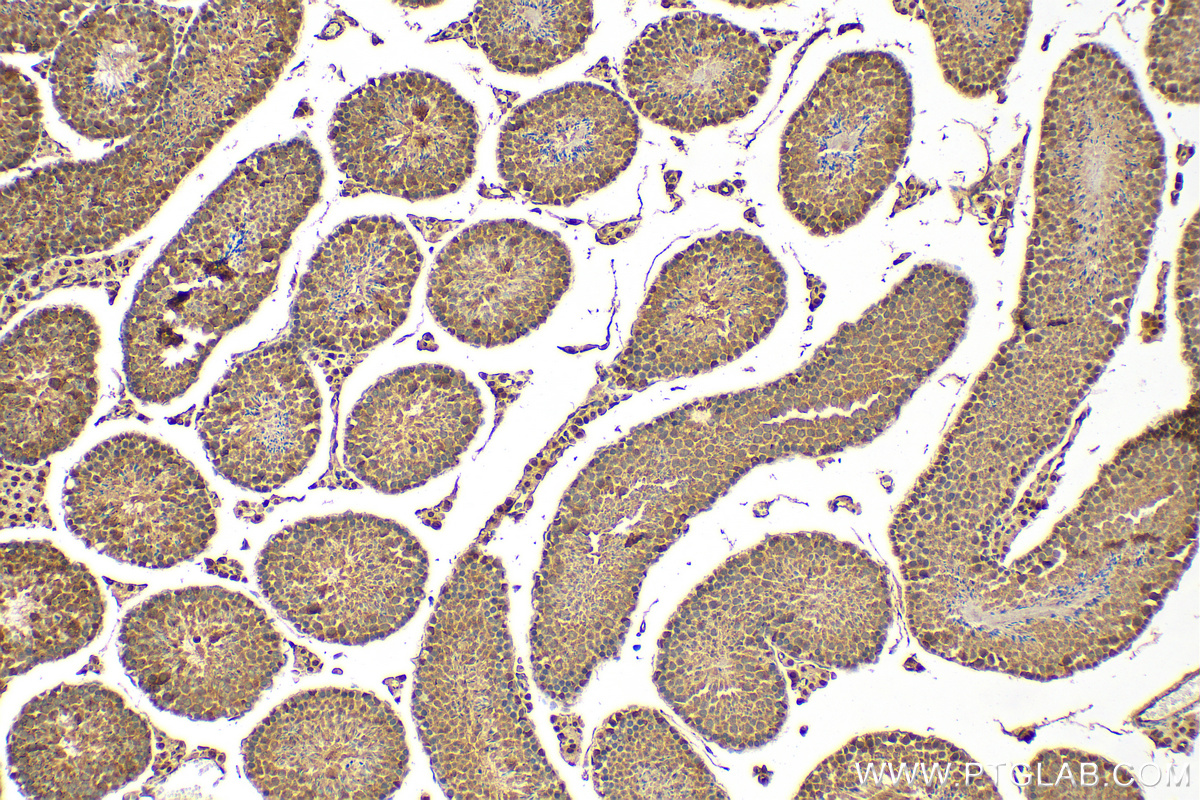 IHC staining of mouse testis using 21224-1-AP