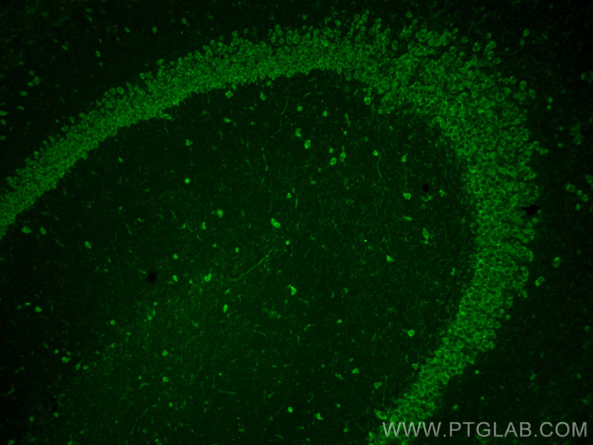 IF Staining of mouse brain using 11545-1-AP