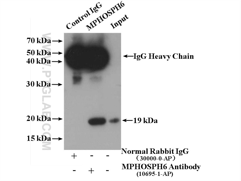 IP experiment of HeLa using 10695-1-AP