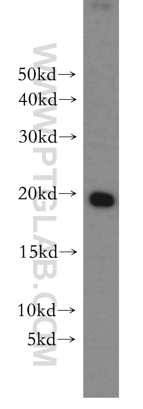 WB analysis of MCF-7 using 10695-1-AP