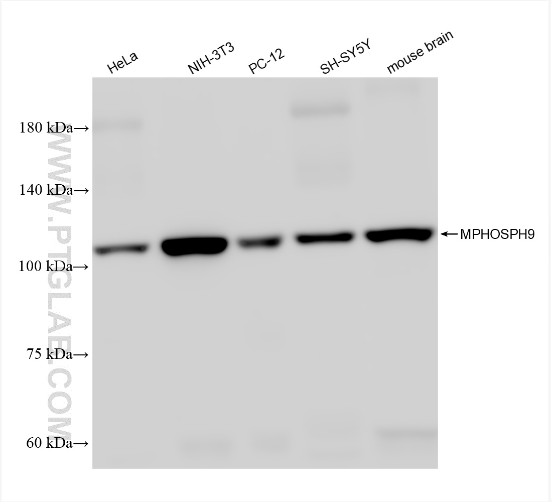 WB analysis using 83397-5-RR (same clone as 83397-5-PBS)