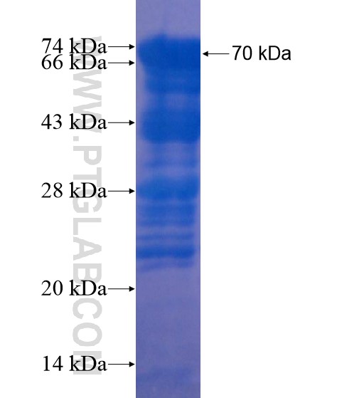 MPHOSPH9 fusion protein Ag22228 SDS-PAGE