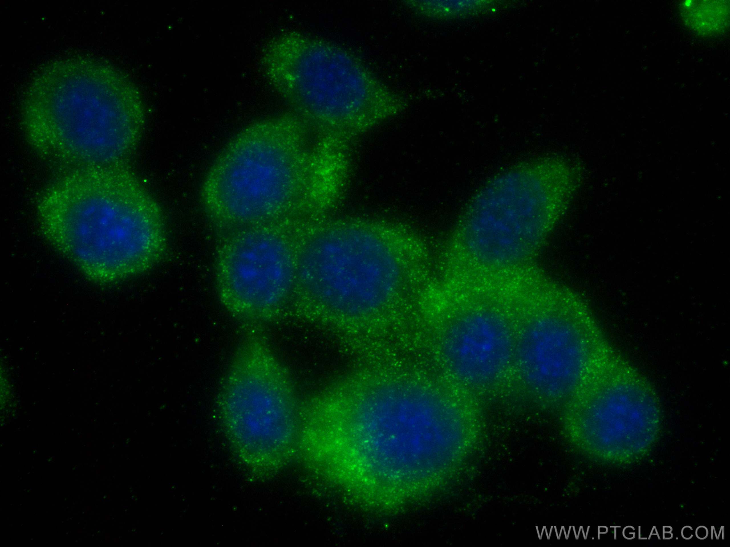 IF Staining of NIH/3T3 using 68417-1-Ig (same clone as 68417-1-PBS)