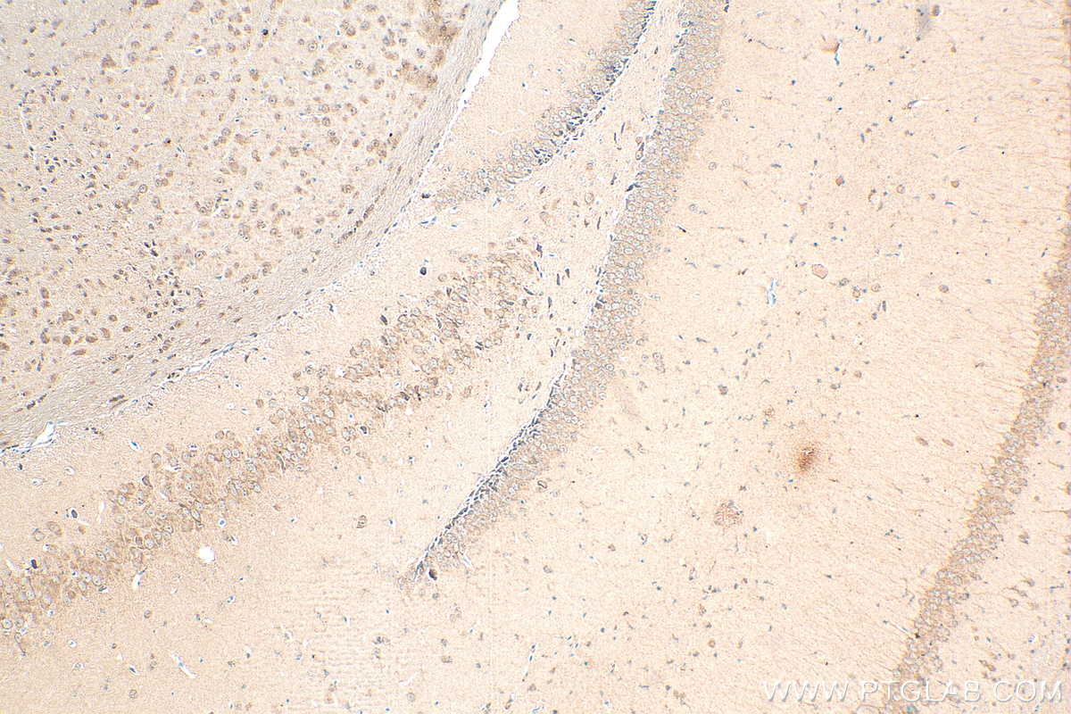 IHC staining of mouse brain using 68417-1-Ig (same clone as 68417-1-PBS)