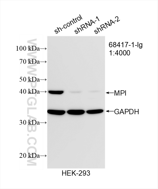 WB analysis of HEK-293 using 68417-1-Ig (same clone as 68417-1-PBS)