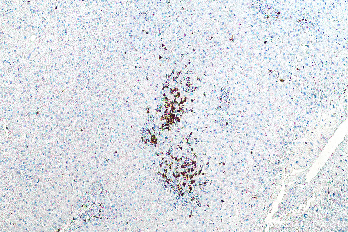 IHC staining of human liver using 81610-1-RR (same clone as 81610-1-PBS)