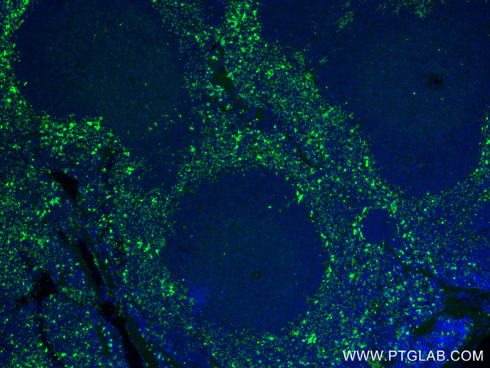 IF Staining of mouse spleen using 84436-5-RR